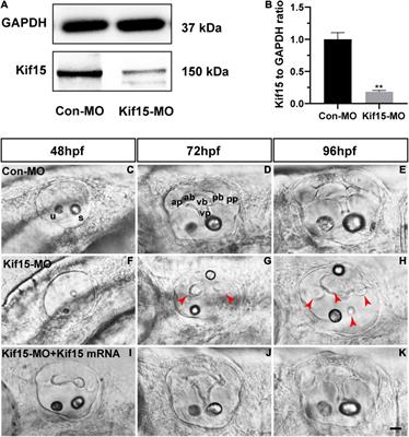 Kif15 Is Required in the Development of Auditory System Using Zebrafish as a Model